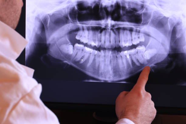 Best Tooth Infection Emergency Dentist  in Lochearn, MD